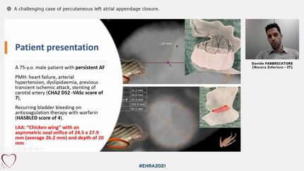 Presentation thumbnail