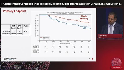 A Randomised Controlled Trial of Ripple Mapping-guided isthmus ablation versus Local Activation Time-guided ablation in Atrial Tachycardia: The Ripple AT-plus study