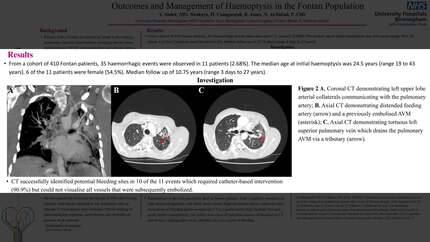 Outcomes and management of Haemoptysis in the Fontan population