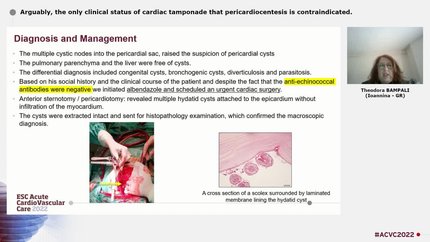 Arguably, the only clinical status of cardiac tamponade that pericardiocentesis is contraindicated.