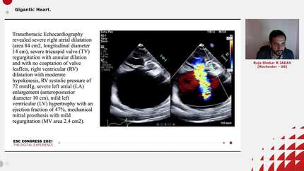 Presentation thumbnail