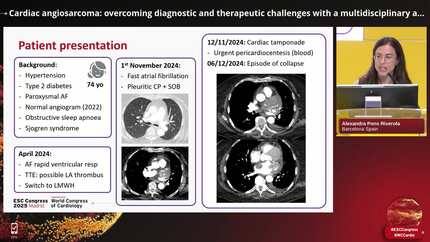 Tumours of the heart