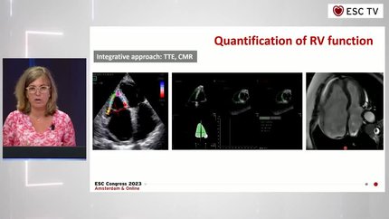 Presentation thumbnail