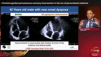 Innovations and breakthroughs in interventional cardiology