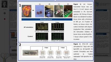 Mechanisms of atrial-fibrillation-induced ventricular dysfunction and recovery in the human left ventricular myocardium