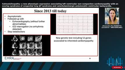 Calmodulinopathy: a new phenotypic expression associating left ventricular non-compaction cardiomyopathy with an overlap syndrome of congenital long QT syndrome and catecholaminergic polymorphic ventricular tachycardia.