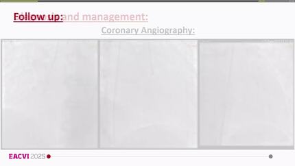 A rare case of coronary anomaly presentation in the adulthood