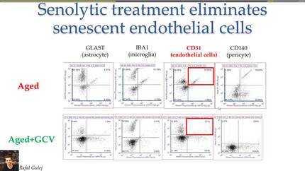 Endothelial plasticity in atherosclerosis