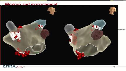 Presentation thumbnail