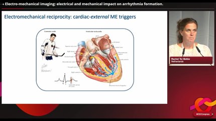 Imaging cellular interaction in arrhythmias to identify novel therapeutic targets