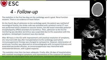 When cardiac transplantation is exceptional before, during and after. 