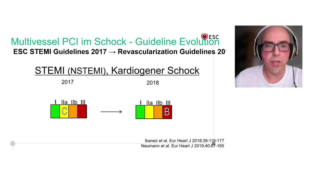 Transforming cardiogenic shock management: groundbreaking evidence and innovations in acute mechanical circulatory support