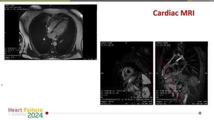 A dangerous mix: life-threatening arrhythmias during concurrent Flecainide and RAF/MEK inhibitors intake.