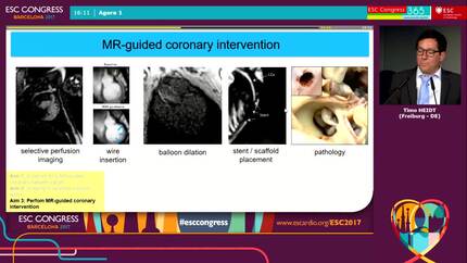Dual approach cardiac MRI for molecular assessment and interventional treatment of vulnerable coronary plaques in a porcine model.