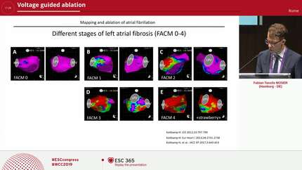 Voltage guided ablation