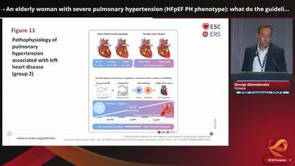 Presentation thumbnail