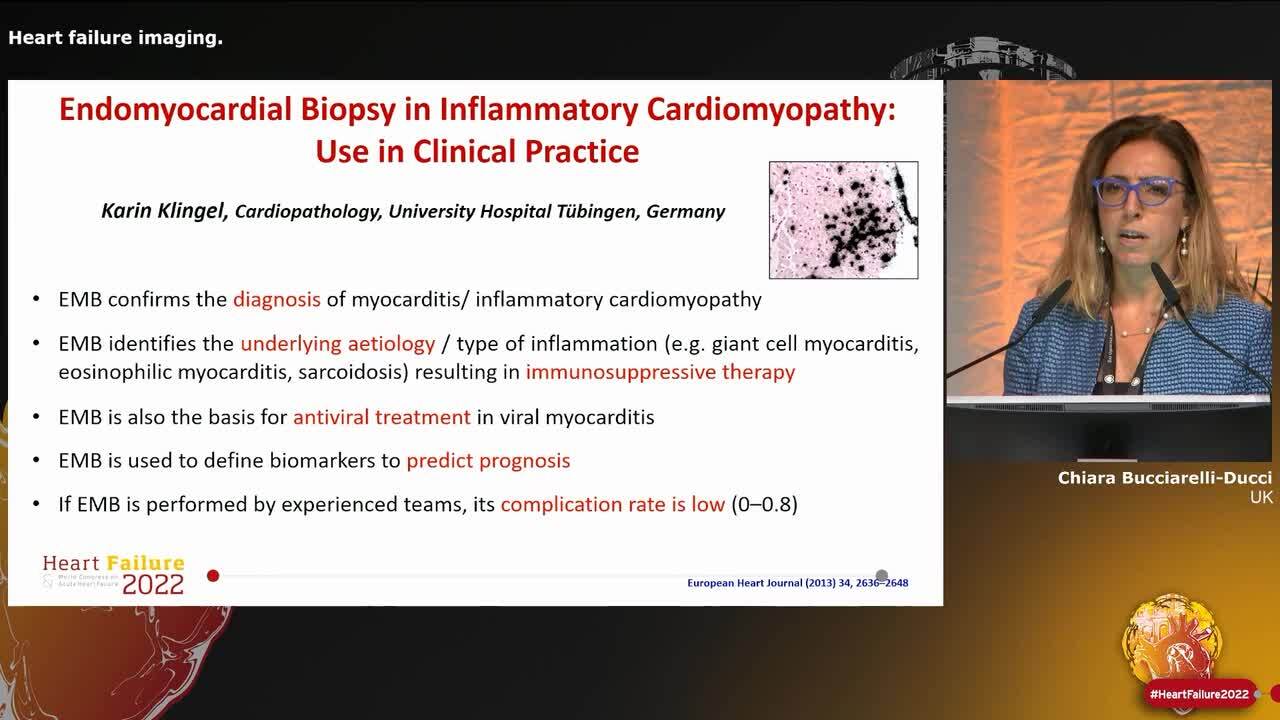Heart failure imaging.