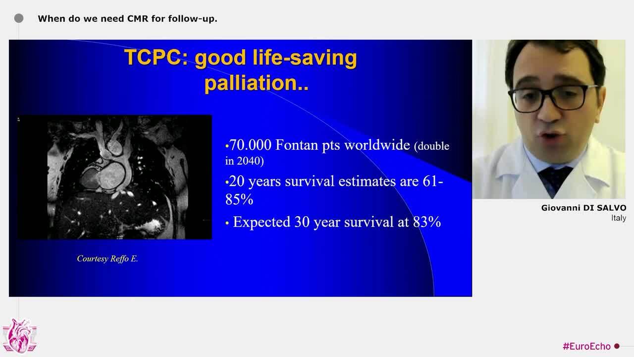 Fundamentals of multimodality imaging in the evaluation of congenital heart disease 