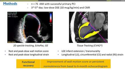 Strain analysis and myocardial viability: a comparative study of cardiac magnetic resonance and stress echocardiography