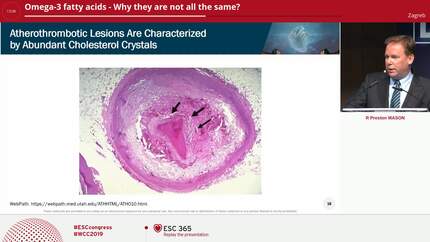Omega-3 fatty acids - Why they are not all the same? 