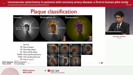 Intravascular polarimetry in patients with coronary artery disease: a first-in-human pilot study