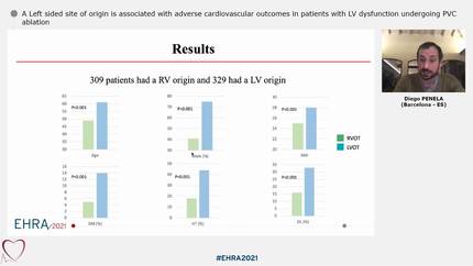 A Left sided site of origin is associated with adverse cardiovascular outcomes in patients with LV dysfunction undergoing PVC ablation