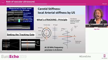 Role of vascular ultrasound.