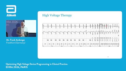 Optimising high voltage device programming in clinical practice