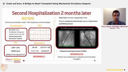 Crash and burn. A Bridge to Heart Transplant Using Mechanical Circulatory Support.
