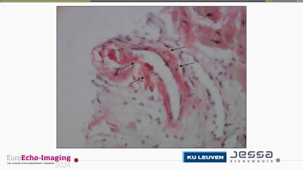 Presentation thumbnail