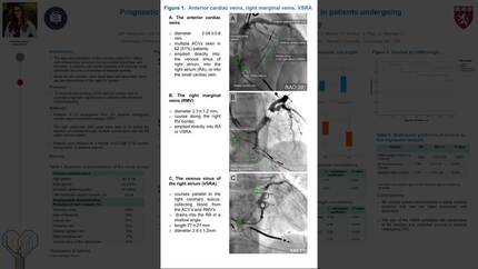 Prognostic value of the right coronary venous anatomy in patients undergoing cardiac resynchronization therapy
