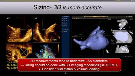 Presentation thumbnail