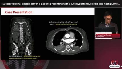 ACVC Clinical cases session 4