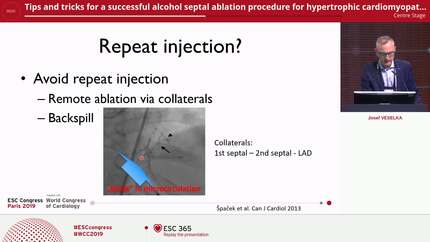 Tips and tricks for a successful alcohol septal ablation procedure for hypertrophic cardiomyopathy.