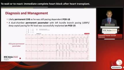 To wait or to react: immediate complete heart block after heart transplant.