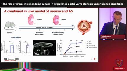 The role of uremic toxin indoxyl sulfate in aggravated aortic valve stenosis under uremic conditions
