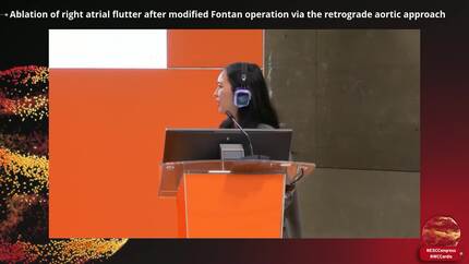 Challenges in atrial fibrillation ablation 