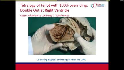 Presentation thumbnail
