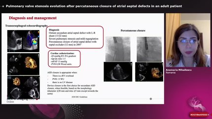 Pulmonary valve stenosis evolution after percutaneous closure of atrial septal defects in an adult patient