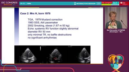 Pregnancy in women with systemic right ventricle