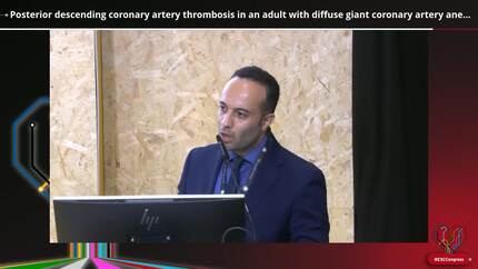 Coronary aneurysms: not so benign!