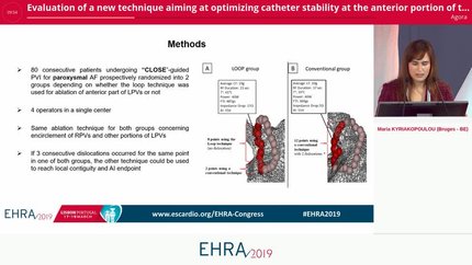 Evaluation of a new technique aiming at optimizing catheter stability at the anterior portion of the left pulmonary veins during radiofrequency catheter ablation for paroxysmal atrial fibrillation.