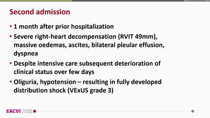 Ruptured sinus of valsalva aneurysm in an adult with down syndrome: the critical role of multimodal imaging and timely surgery