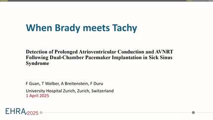 Supraventricular tachycardia