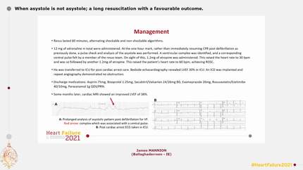 When asystole is not asystole; a long resuscitation with a favourable outcome.