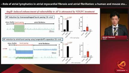 Role of atrial lymphatics in atrial myocardial fibrosis and atrial fibrillation: a human and mouse study