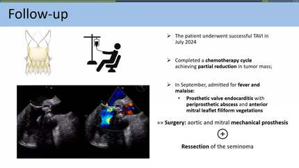 Presentation thumbnail