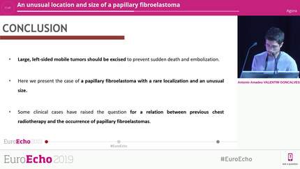 An unusual location and size of a papillary fibroelastoma