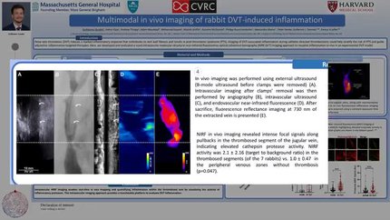 Multimodal in vivo imaging of rabbit DVT-induced inflammation