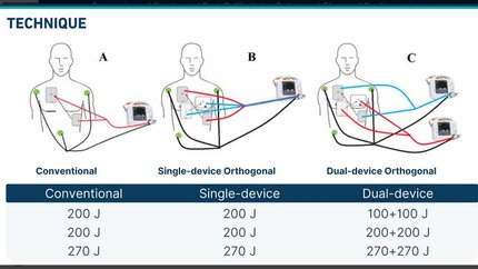 Comparison the efficacy of single and dual defibrillator orthogonal electrical cardioversion in persistent atrial fibrillation
